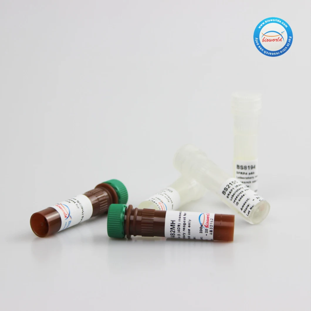 CE, ISO9001 Approved P18 Ink4c (D142) Polyclonal Antibody