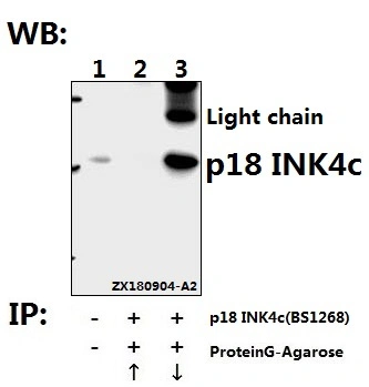 CE, ISO9001 Approved P18 Ink4c (D142) Polyclonal Antibody