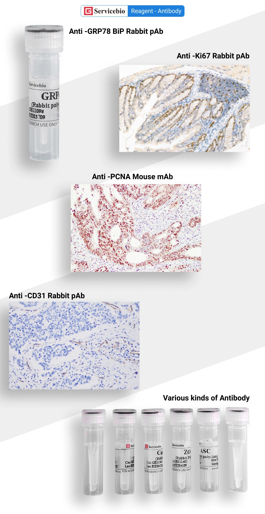 Biological Antibodies Recombinant Mouse Mab Anti-Flag Tag Antibody