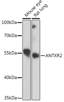 Antxr2 Polyclonal Antibody
