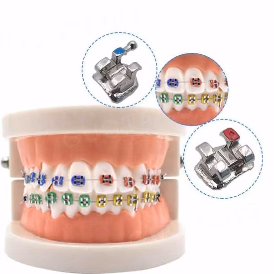 Orthodontic Use Dental Ceramic Tongue Side Buckle Consumables Dental